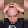 Hair Growth Spray